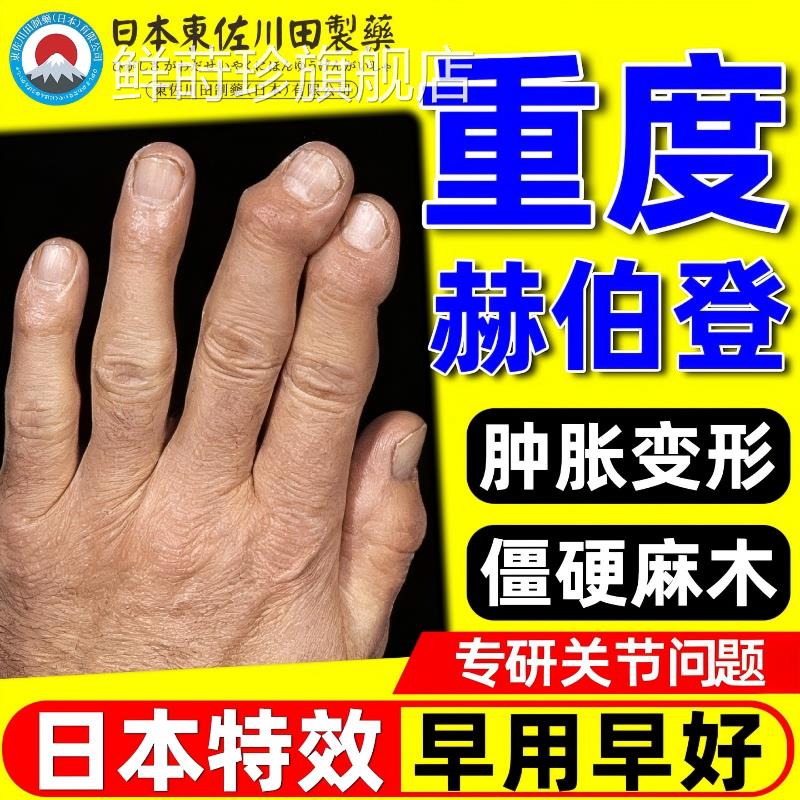 赫伯登结大节专用膏贴手指类风变形肿僵硬伸屈困难正品官方鲜莳珍