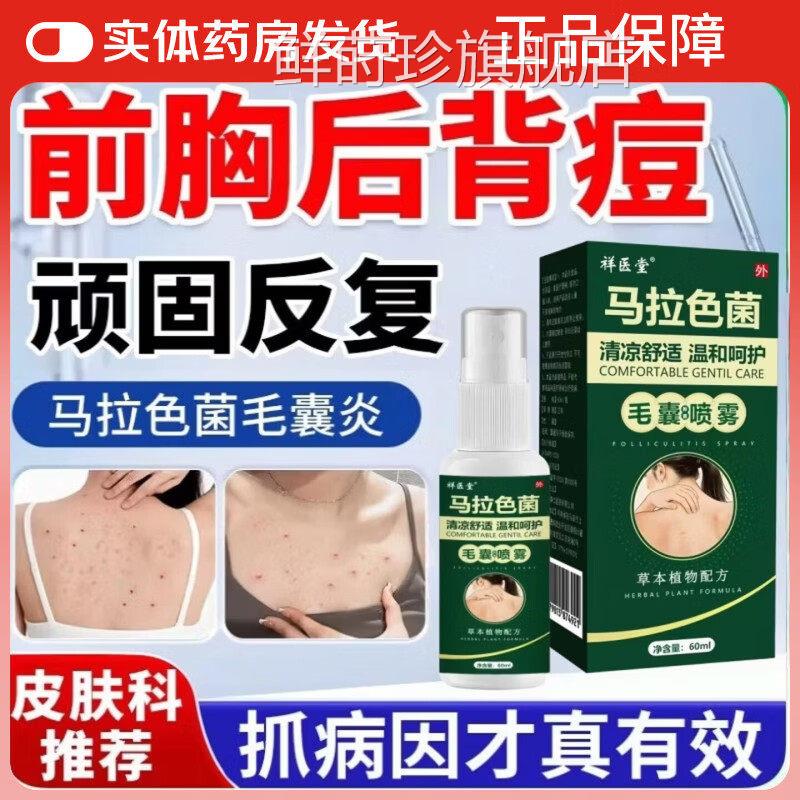 祥医堂马拉色菌毛囊真炎抗菌喷剂脓包疙瘩搭胸前后背头皮药喷雾剂