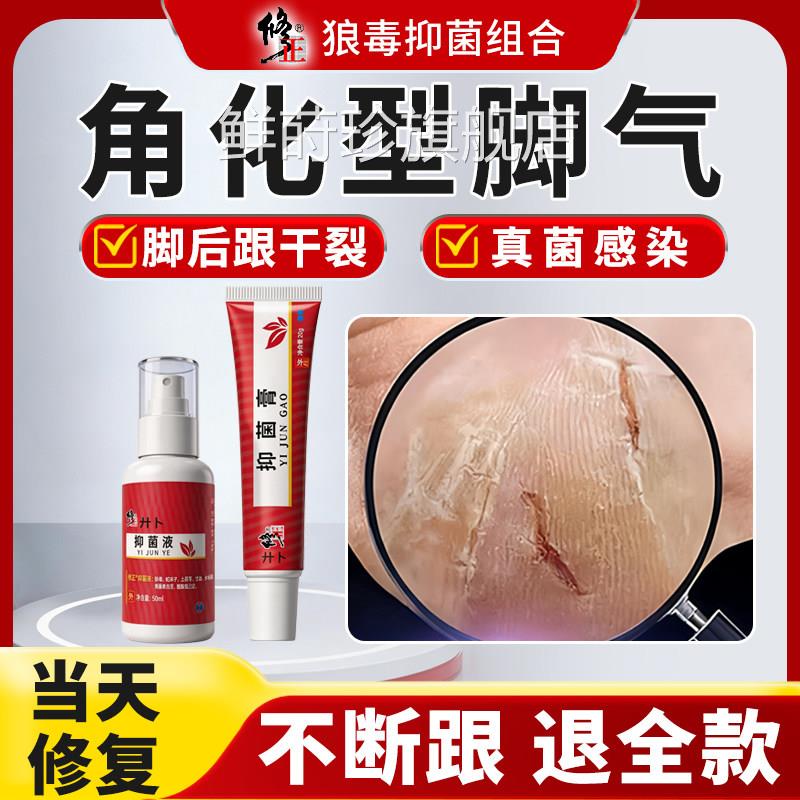 鳞屑角化型脚气脚后跟干裂开裂皮皲裂脱痒足癣真菌感染去非死皮治