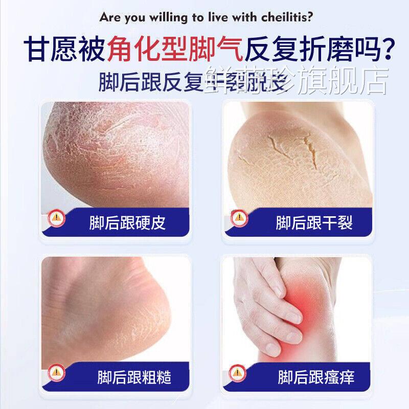 角足爽净喷化型脚乞手脚后跟粗糙硬化干皲裂剂脱皮鲜莳珍旗舰店