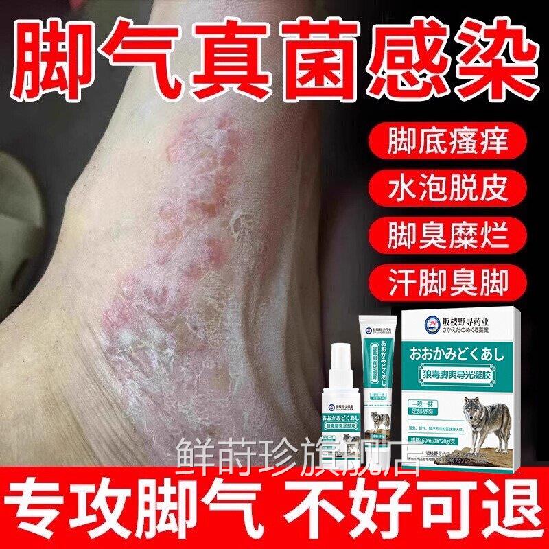 脚气喷雾止皮痒杀菌去真菌感染专用除臭脚出汗糜烂脚丫脱脚趾缝根