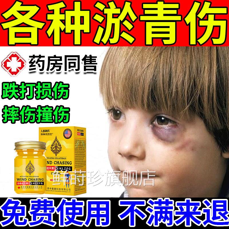 淤青快速消除宝宝淤青膏眼部眼睛活血化瘀去膏淤青摔倒膝盖腿磕碰