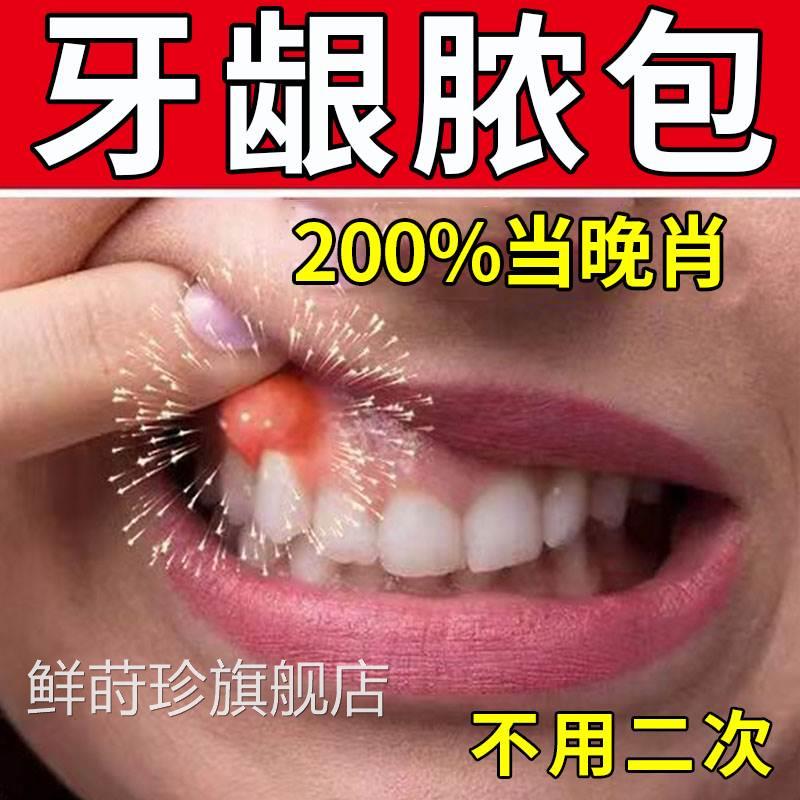 一秒消包】牙龈肿包痛瘘管上火智齿牙周齿疼流脓修复牙根发炎喷剂