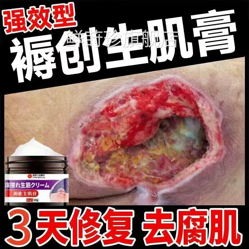 日本生肌去腐膏伤口愈合进长肉膏专用卧床老促人臀部屁屁外用空洞