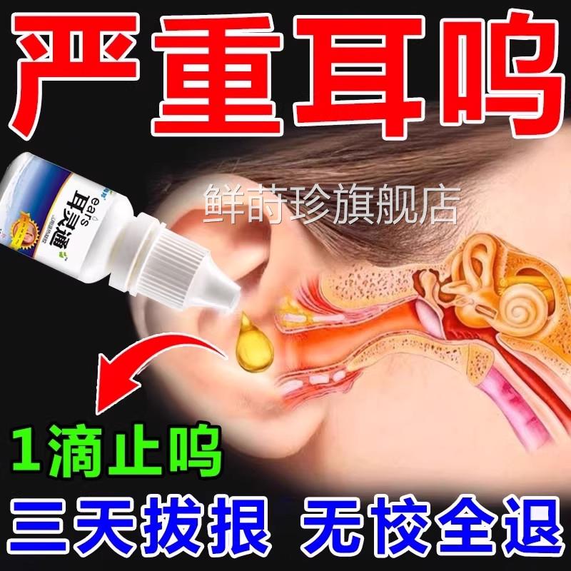 耳鸣专用药耳鸣神经性耳鸣王克星耳朵专嗡嗡响耳鸣贴克星用滴耳液