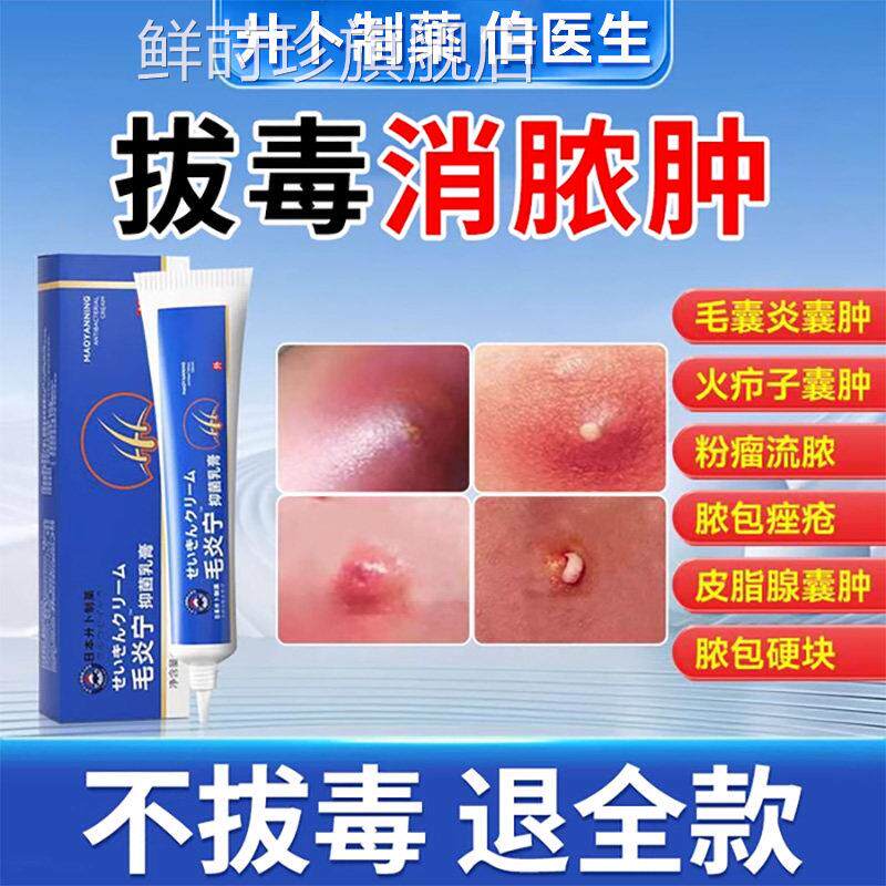疖肿断痒拔毒膏火疖子的囊皮肿痛脓包脂腺痘痘痒私处外阴囊毛囊炎