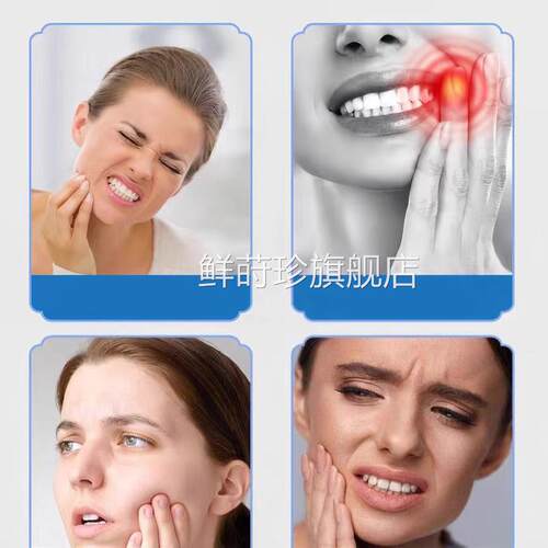 牙痛宁止喷雾剂疼药水牙杀牙神经死肿痛疼效蛀虫烂特的牙齿鲜莳珍