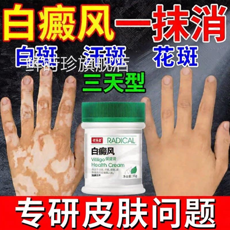 白癜风药膏快速消白斑汗斑花斑皮肤痒用专促黑色素生骨补脂酊遮盖