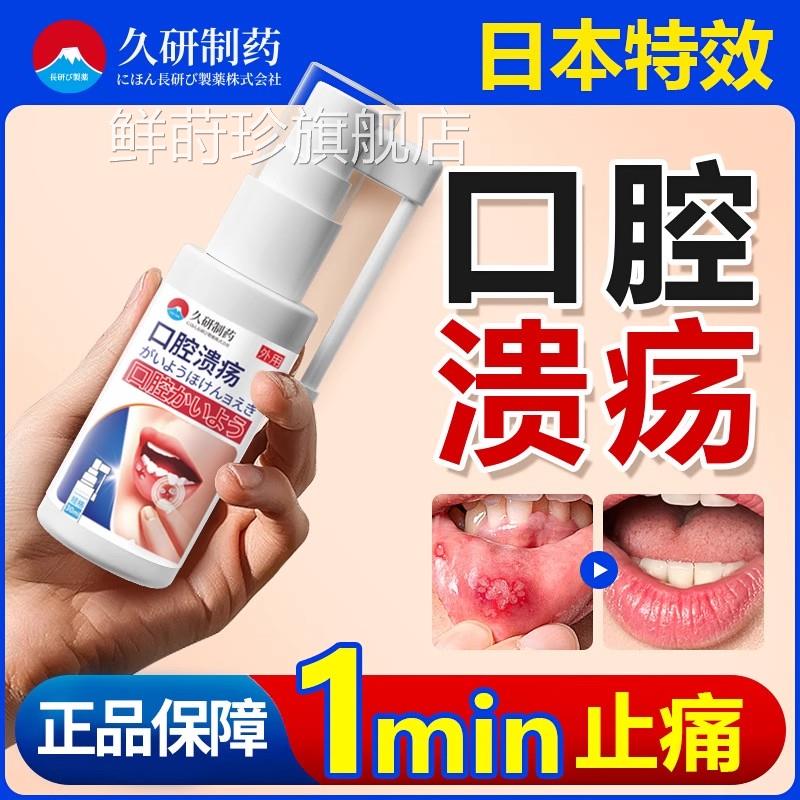 日本口腔溃疡一点灵喷扁平苔藓剂治疗凝胶修复维生素黏膜专用正品