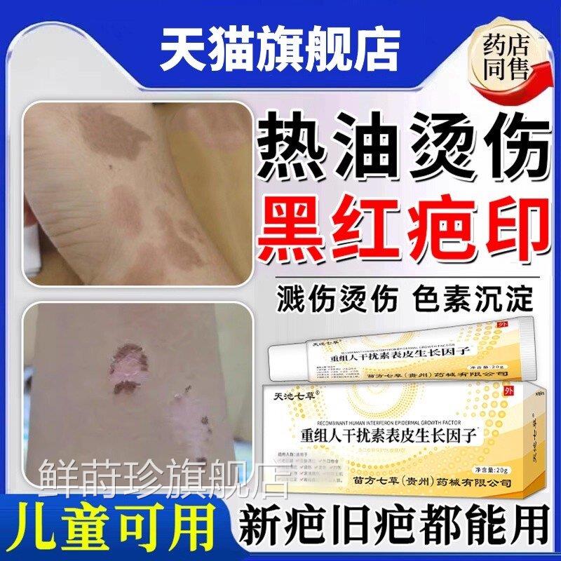热油油烫伤烧伤去疤印膏疤痕修复除疤膏儿童祛去红黑印色素沉淀20