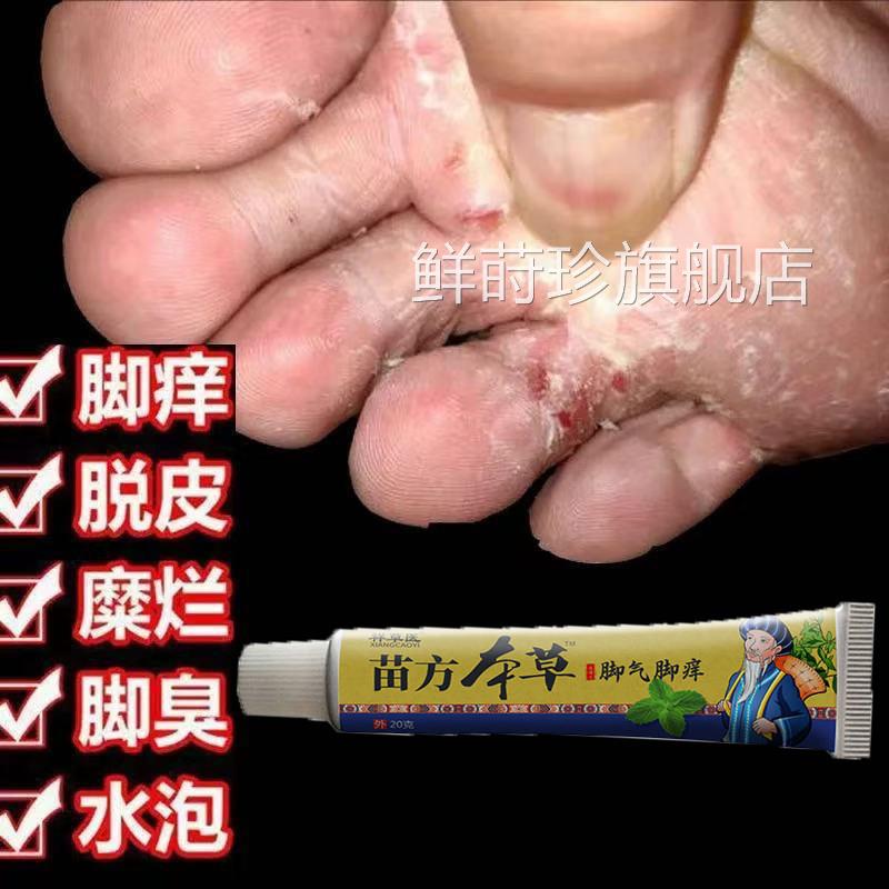脚气膏抑菌专用止痒脱皮杀菌臭脚出汗真菌专用脚丫脚趾烂缝糜烂痒