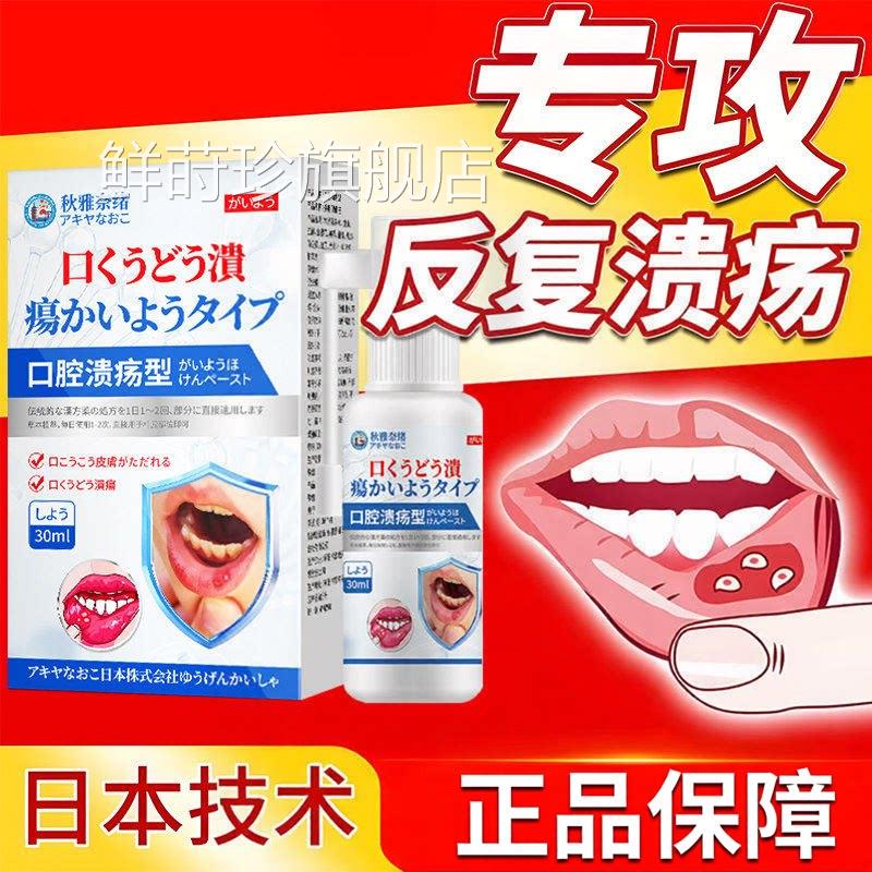 【日本进口】口腔溃疡嘴巴舌头泡烂内壁起泡疼痛修复痛白溃疡喷剂