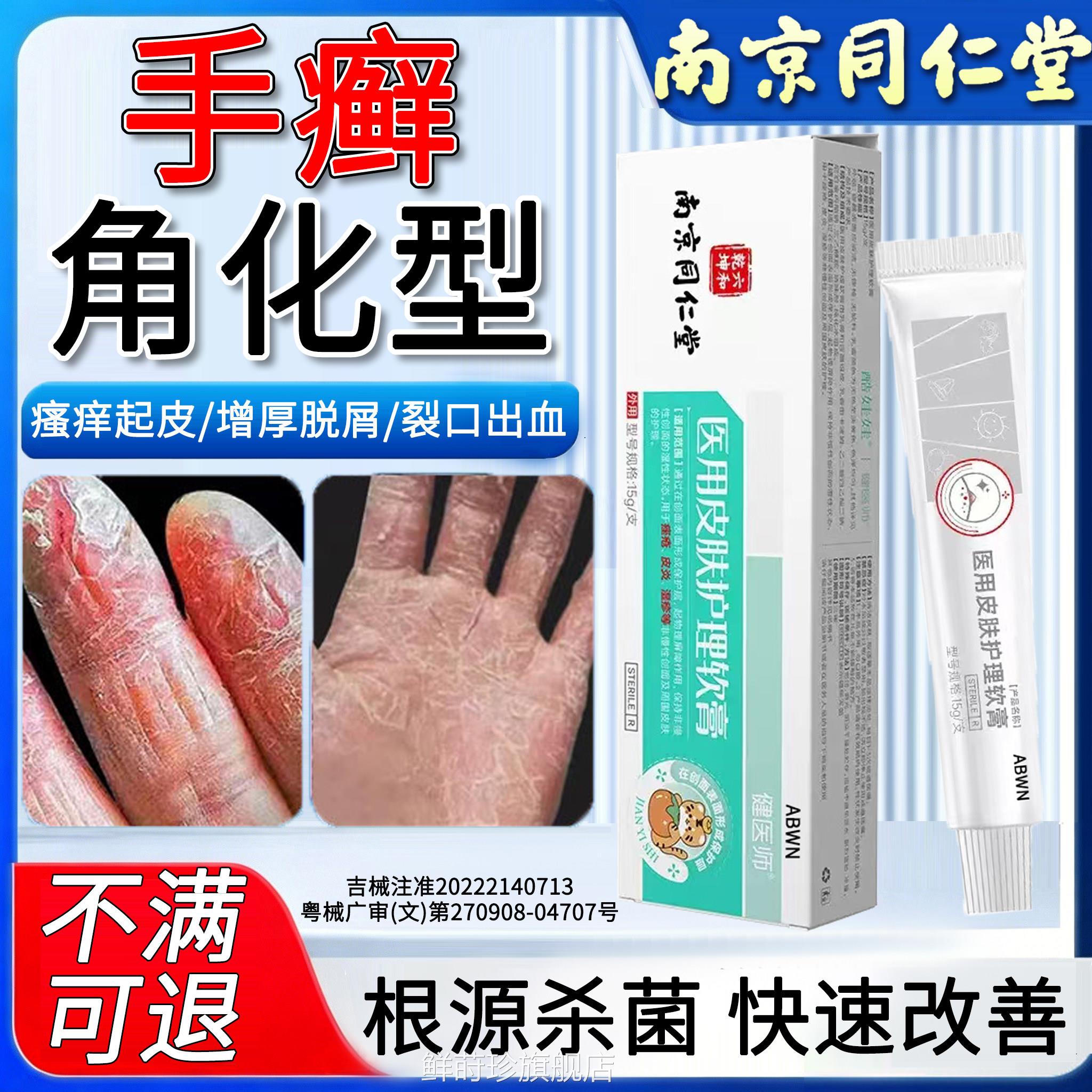 角化型手癣膏鹅掌风专药用去部脱皮干裂真菌感染手根止湿痒抑菌疹