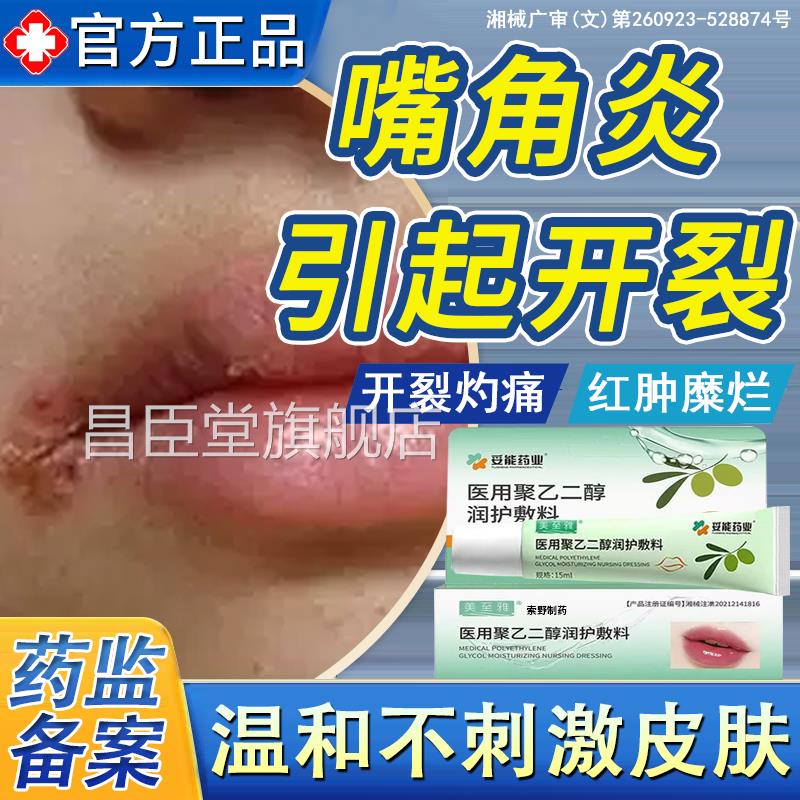 口角炎引起干裂烂嘴角开裂口干燥起皮嘴唇脱裂皮溃疡可搭药膏XH昌