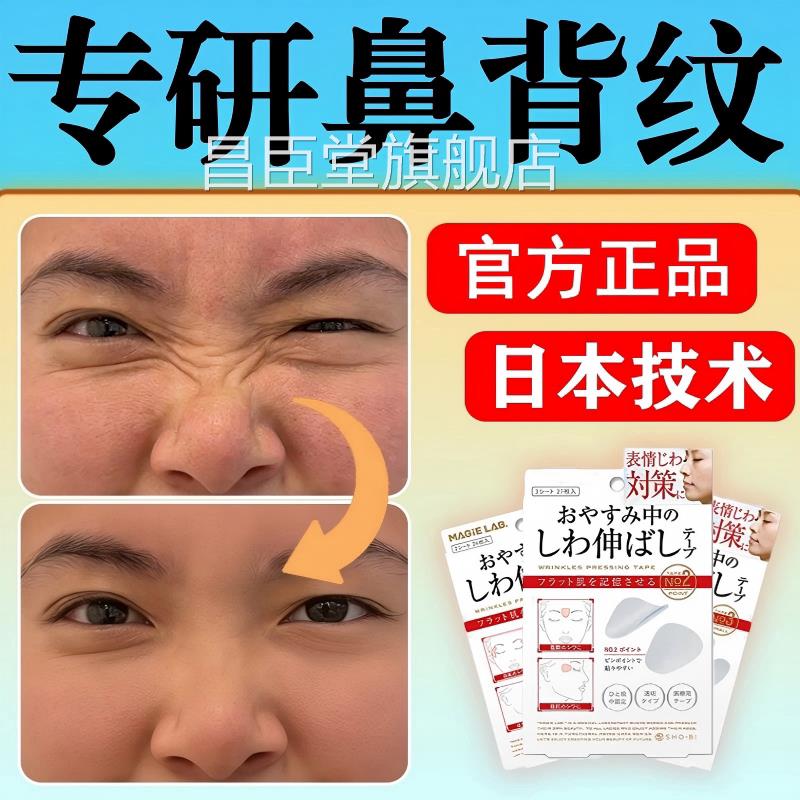 日本鼻背去除脸上鼻梁横纹贴淡化山根纹褶皱纹鼻子上有细纹路yy昌