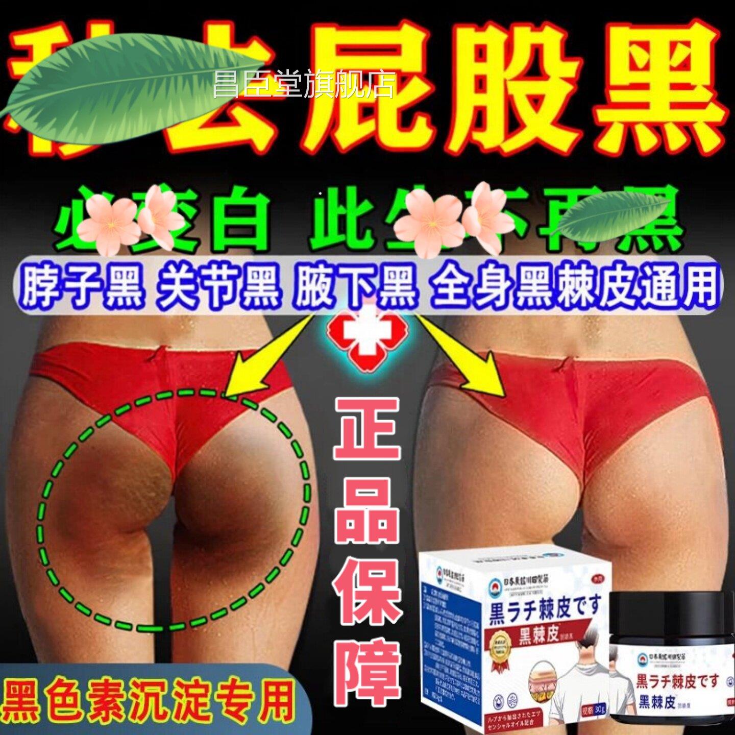 日本脖子大腿内侧黑色素沉淀去除屁股祛黑坐印臀部发黑坐茧棘皮膏