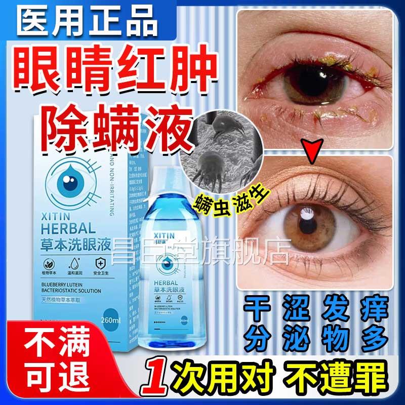 除螨眼液眼洗睛有螨虫眼红干痒痛医用清洁消炎去异物止痒眼药水ZT