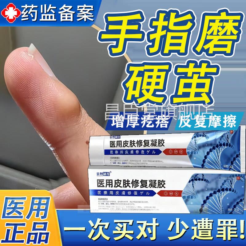 手指头起写字茧手茧子去膏除神器手上长硬疙瘩去死皮老茧软化剂TK