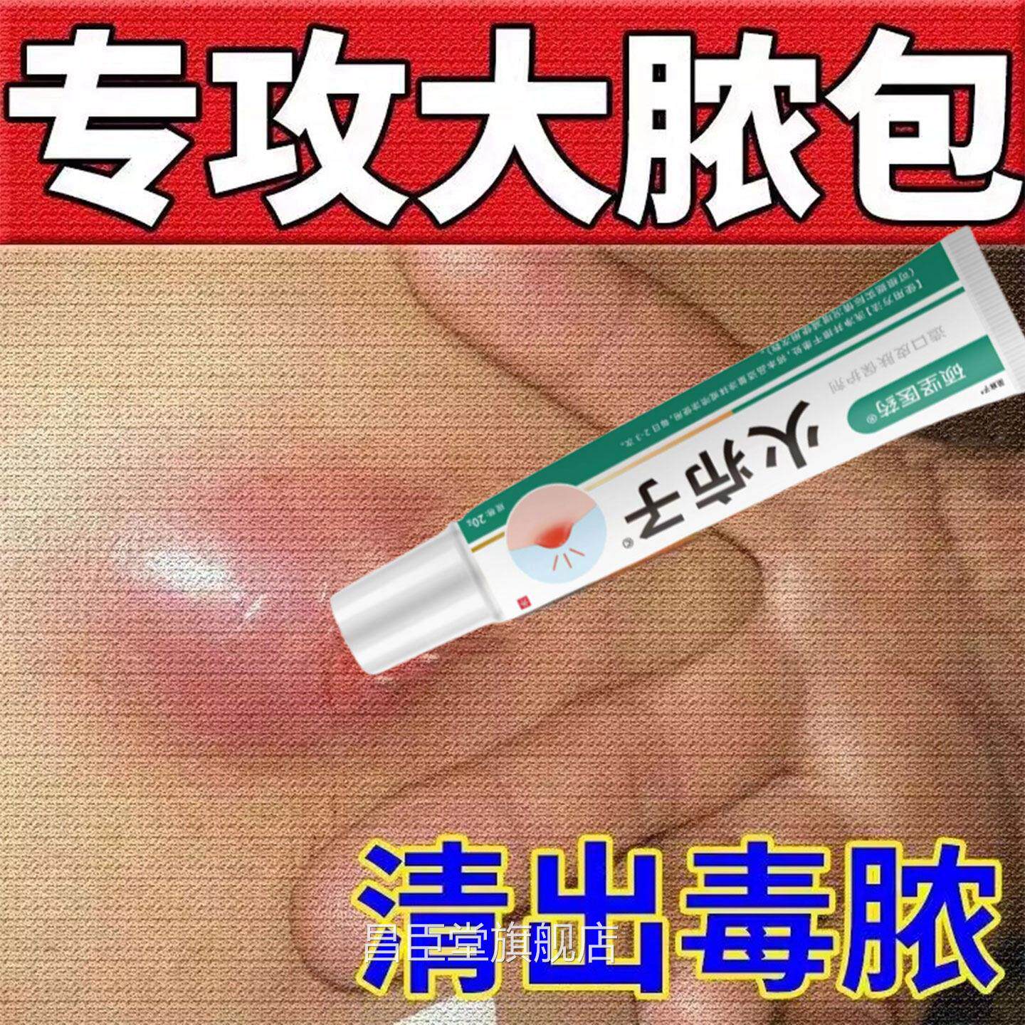 火子乳膏旗舰店屁股坐板疖肿疖拔毒拔脓止痒皮脂腺皮肤抑外用软膏