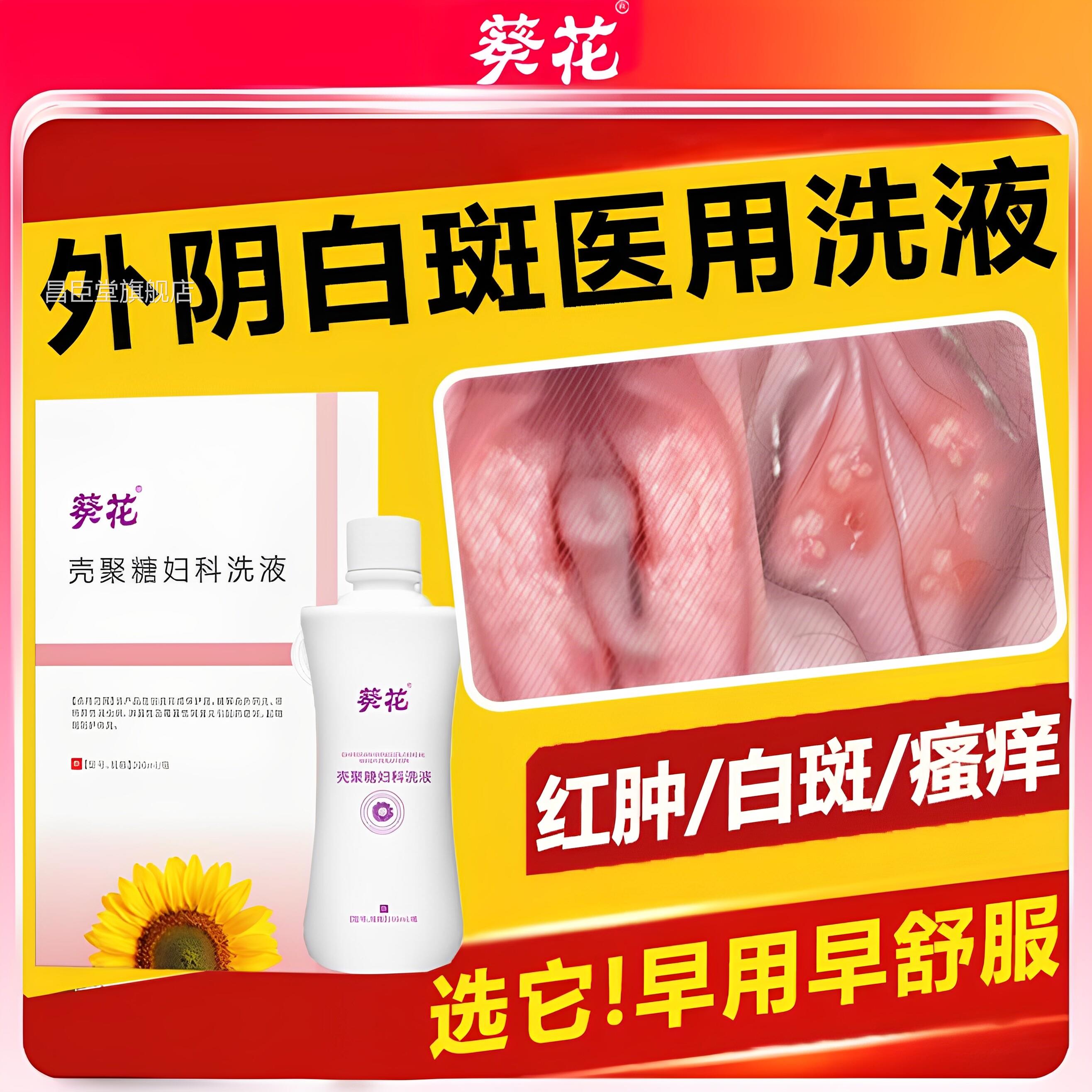 外阴白斑萎缩医用洗液去私处根妇科瘙痒止痒专用膏药房同款女膏RS