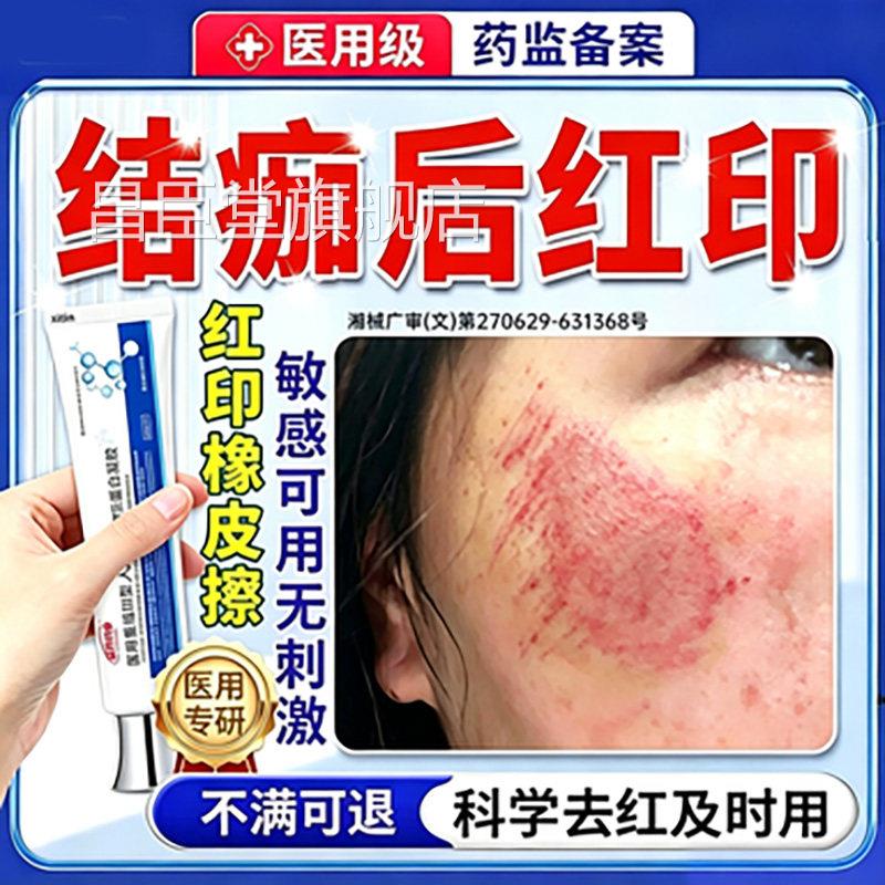 擦伤摔伤结痂后疤痕修复膏除疤去黑色素沉淀点痣去红印退红淡印FY