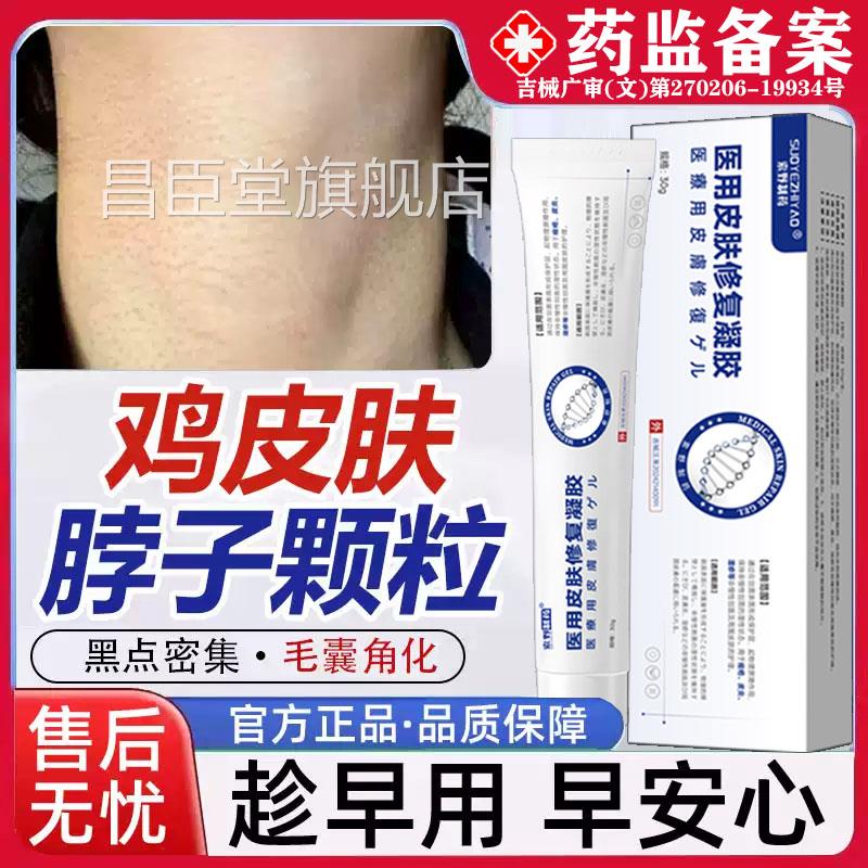 去脖子皮肤疙瘩毛囊角化症专用毛囊炎去除颈鸡部鸡皮药房同款膏QQ