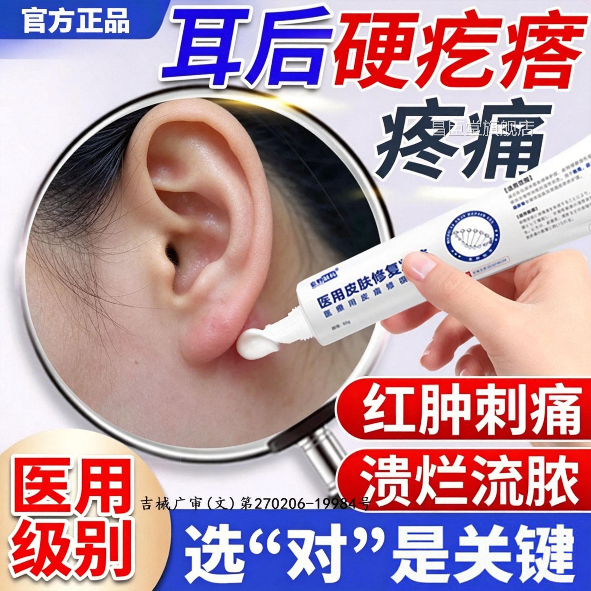 耳鼓包硬块痘皮脂腺囊肿粉瘤疖肿拔毒拔脓专用火疖后子敷料贴膏LX