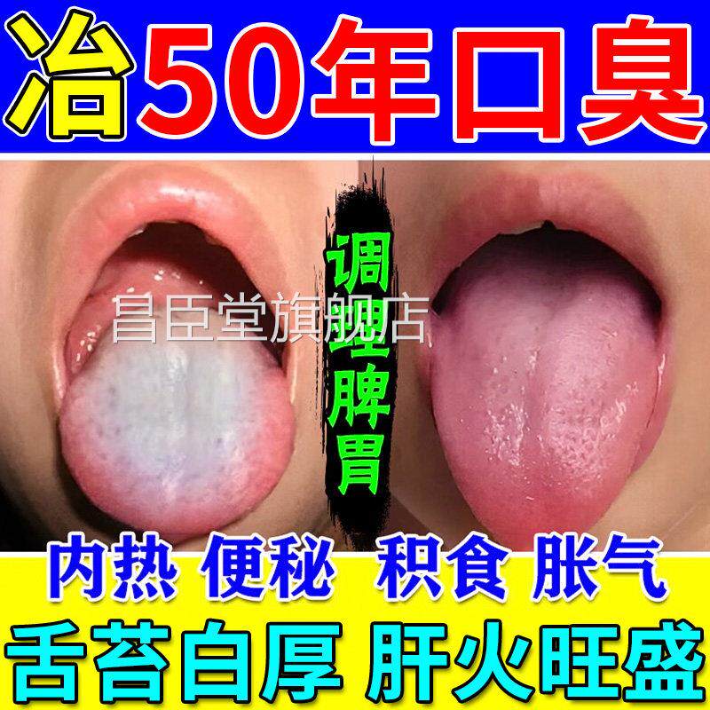 口苦口臭清新贴口臭丸气古韵清肚脐贴保健贴便秘口口干调理脾胃昌