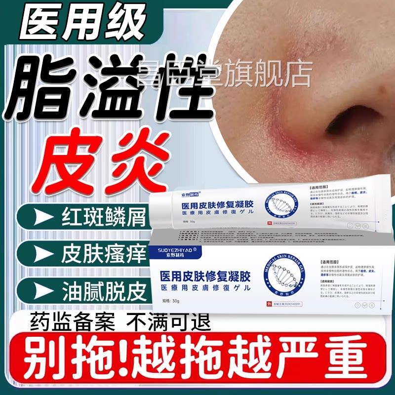 鼻子脂溢性皮炎鼻翼两侧泛红部脸上皮肤干燥起面皮脱皮软膏Y7昌臣