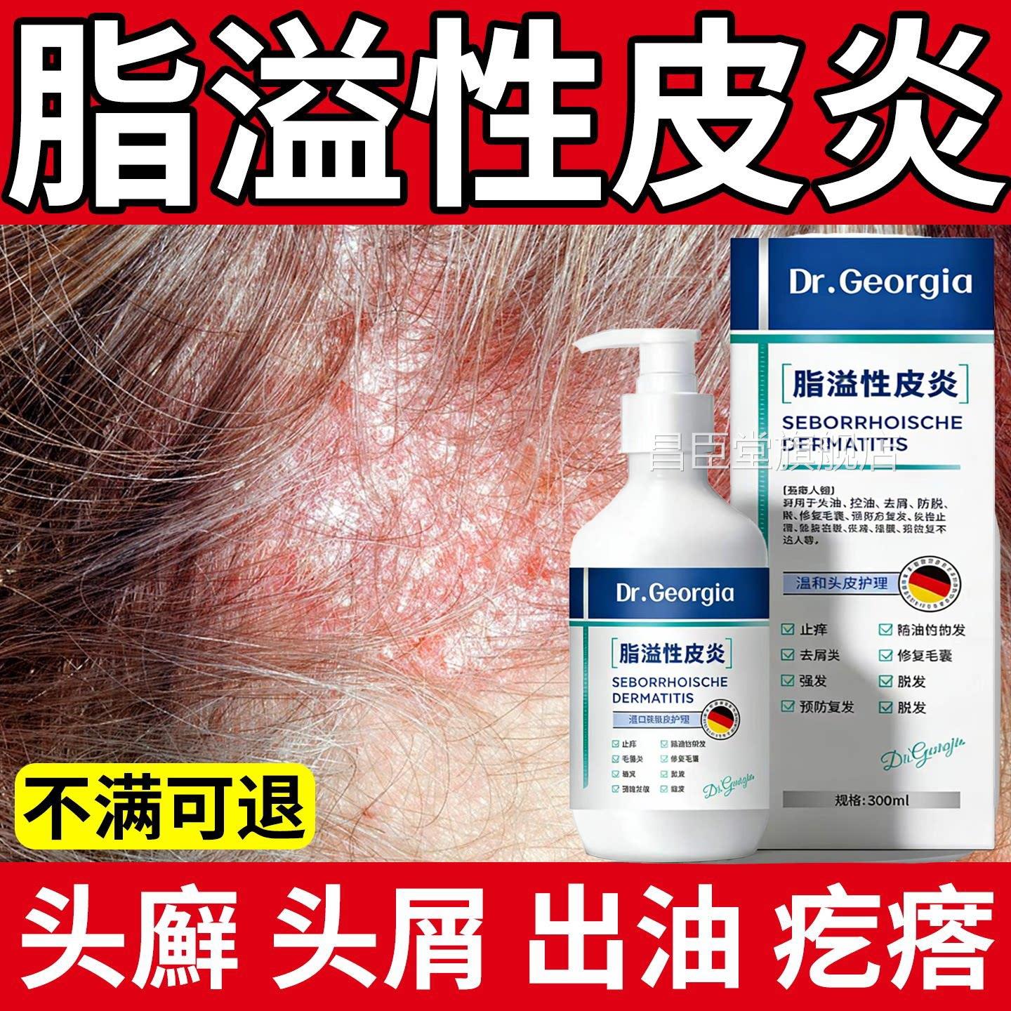 【德国技术】脂溢性皮炎毛囊洗发水止痒抑头部屑马拉色除炎螨抑菌