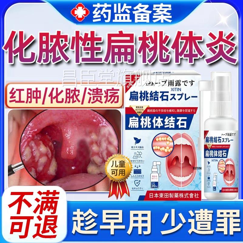 急性化脓性扁桃炎专用喷雾剂体喉咙肿痛扁桃体炎用的嗓子疼红肿PP