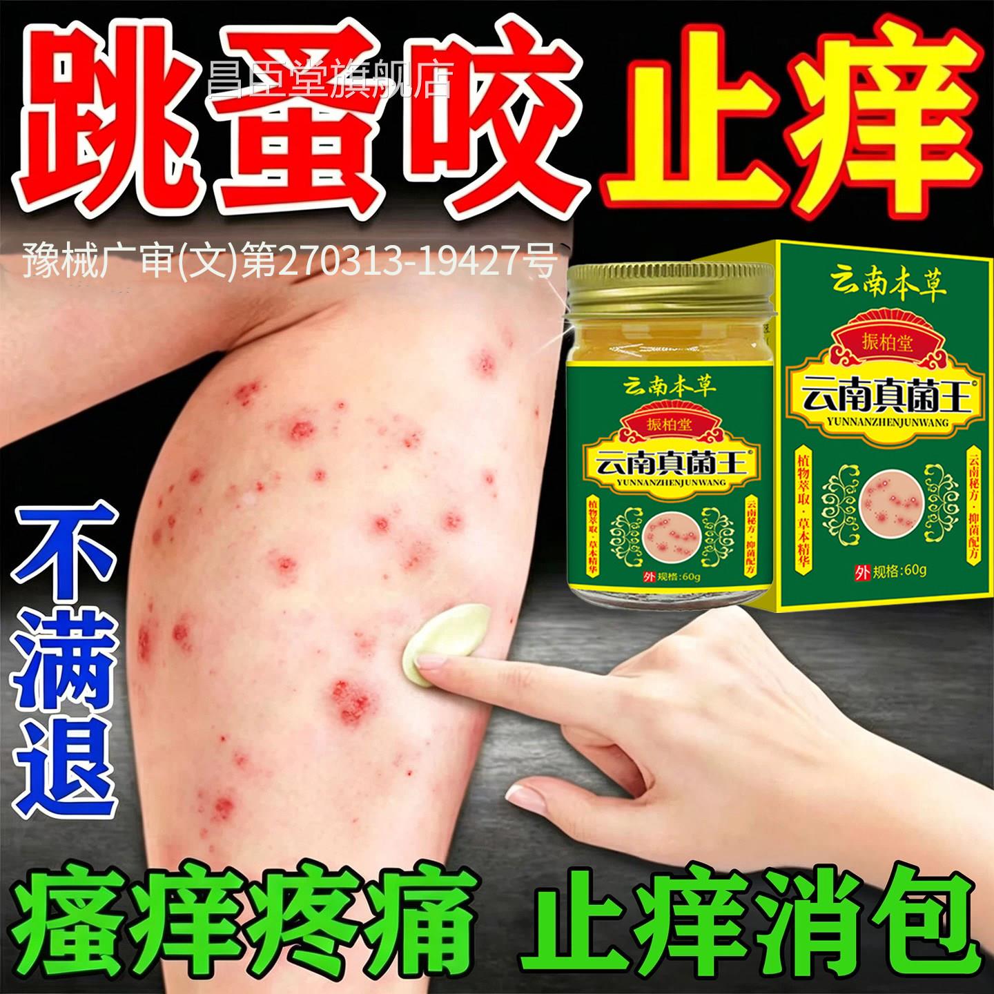 跳蚤叮咬止痒膏瘙痒红肿专用毒臭虫红过火蚁蚂蚁隐翅虫皮肤敏外用
