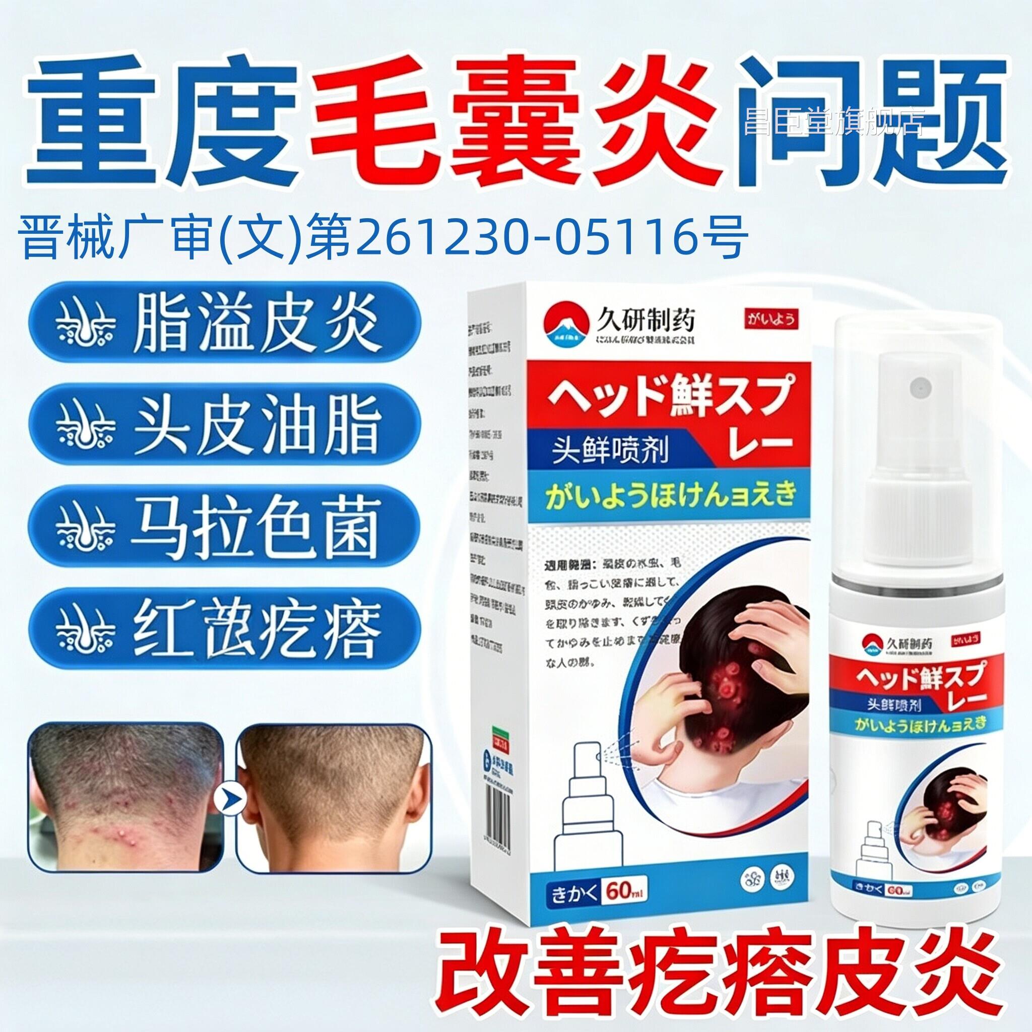 头皮毛炎长痘疙瘩红专头部特脸效上用脂溢囊性皮炎马拉色菌痒昌臣
