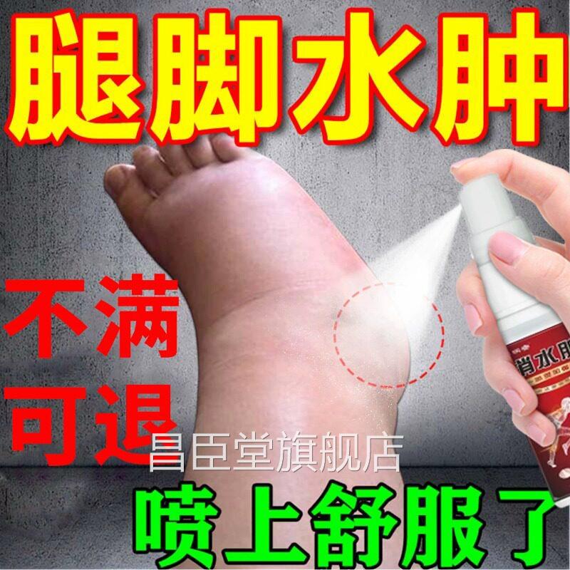 去老人下肢水肿脚肿瘀消肿专用浮肿老人活血化止痛利水利尿排贴膏