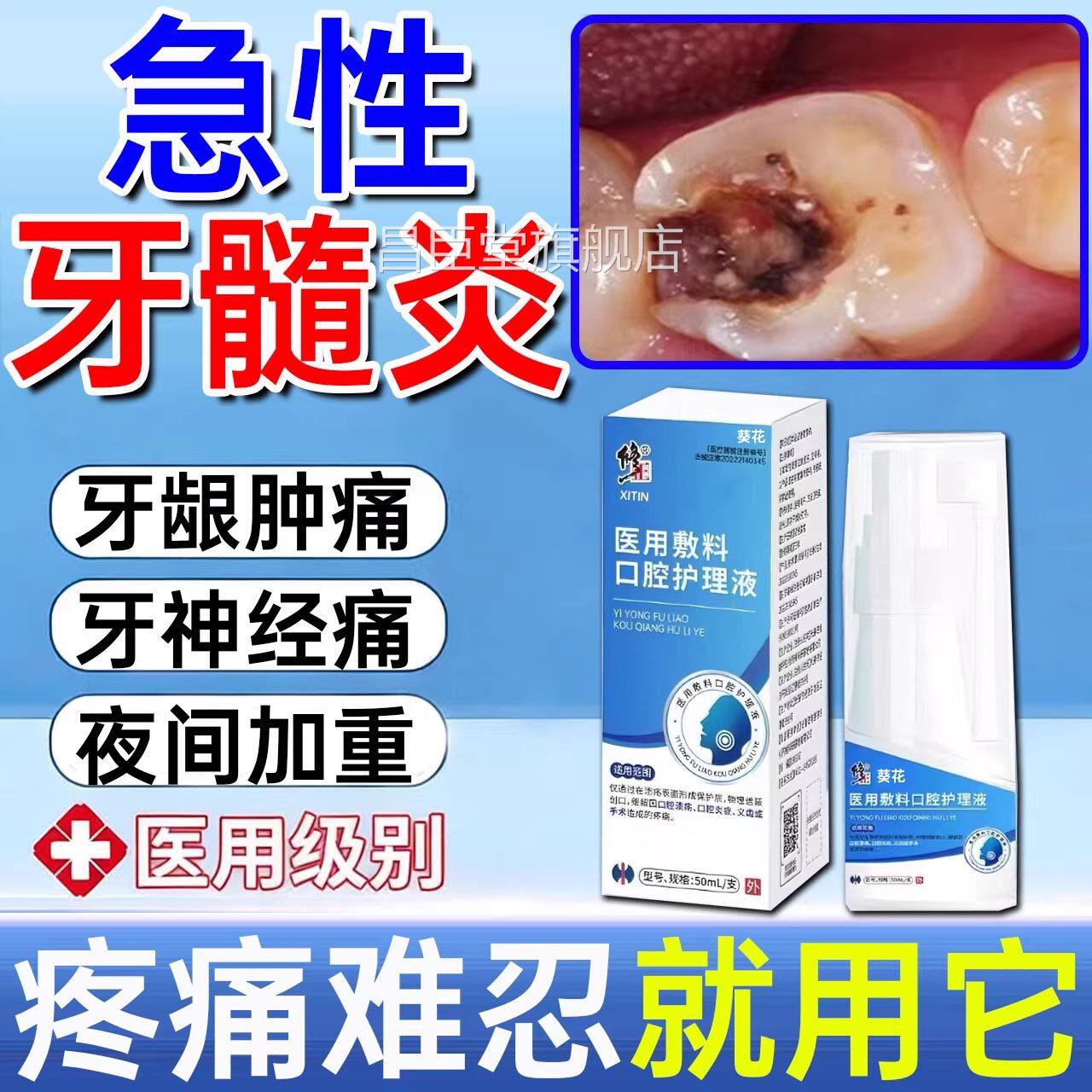 急性牙肿髓炎牙疼牙痛牙龈肿痛牙神经疼痛牙周脓止痛专用喷剂Y7昌