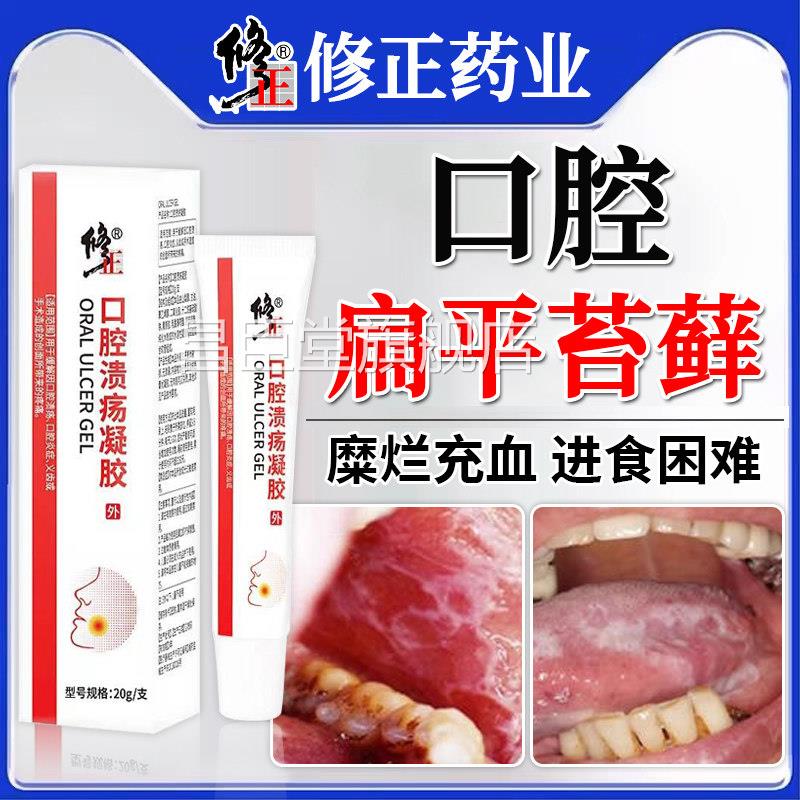 口扁平苔藓专用治疗黏膜修复白斑液膏纤维化口疮溃腔疡充血GX昌臣