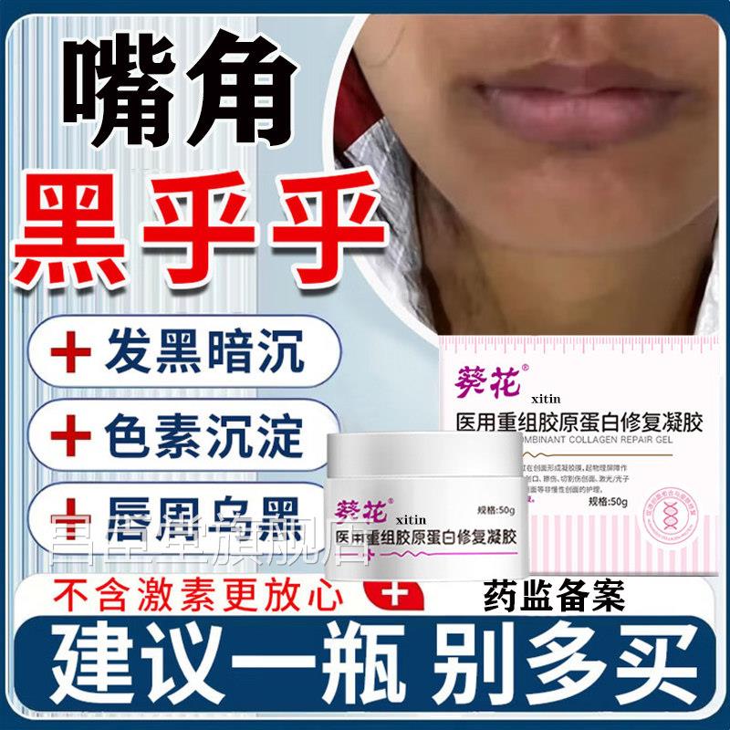 嘴角发黑黑色素沉淀去除唇改善唇周黑黑嘴角暗沉唇炎色素沉着膏LT