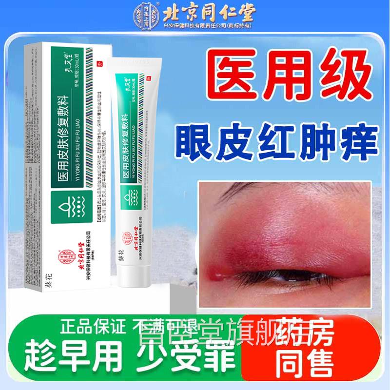 眼皮红肿痒眼睛周围过敏发癣神经性皮炎眼角痒干燥痒起皮掉屑RS昌