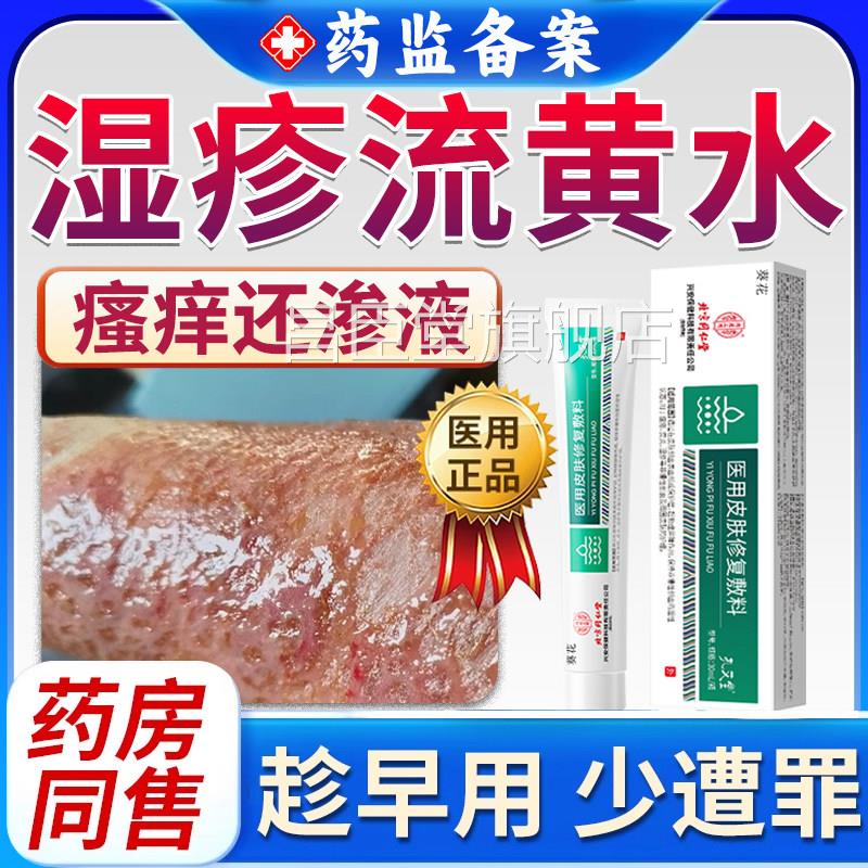 湿疹用除湿治皮肤瘙痒专疗流黄水疮脓疱疮水泡渗液结痂止痒软膏RS