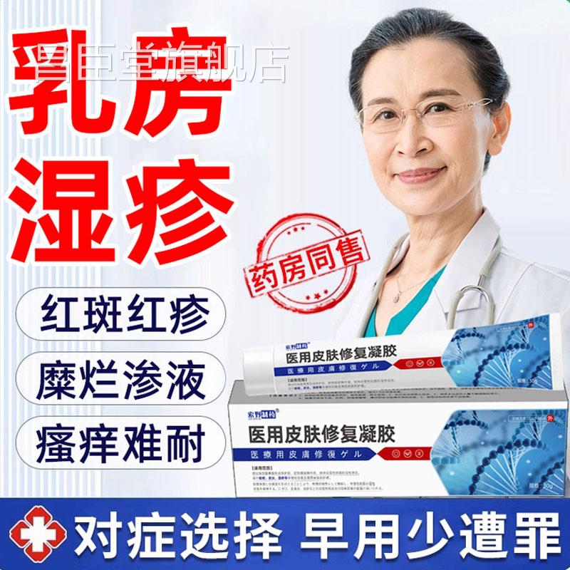 乳止头瘙痒乳房皲裂湿疹痒去红斑湿疹根乳晕水泡药房同售膏QQ昌臣