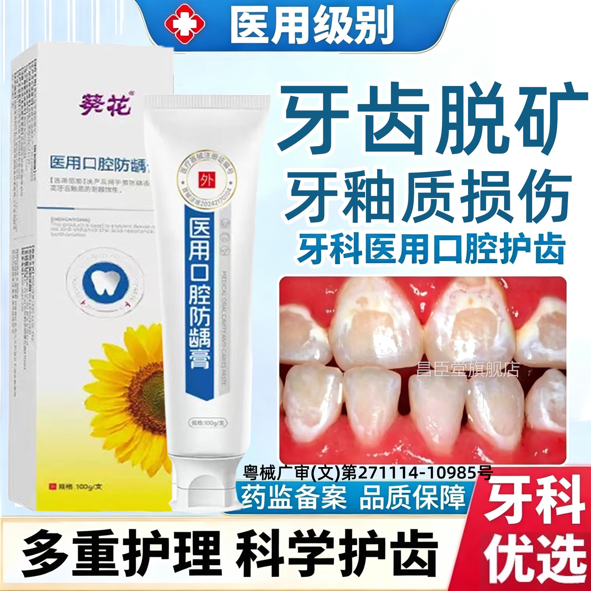 儿童牙齿脱白斑钙化含氟再矿化修护牙膏防蛀牙龋齿修复牙釉质矿XH