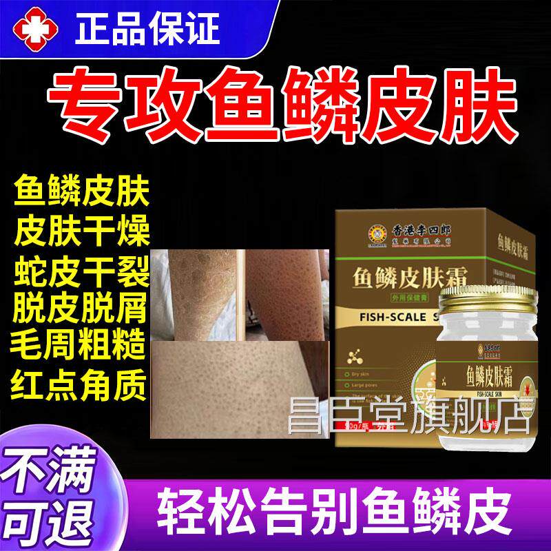 鱼鳞病皮肤角霜祛鸡蛇皮肤疙瘩毛囊化身体乳保湿滋润女皮肤干燥昌