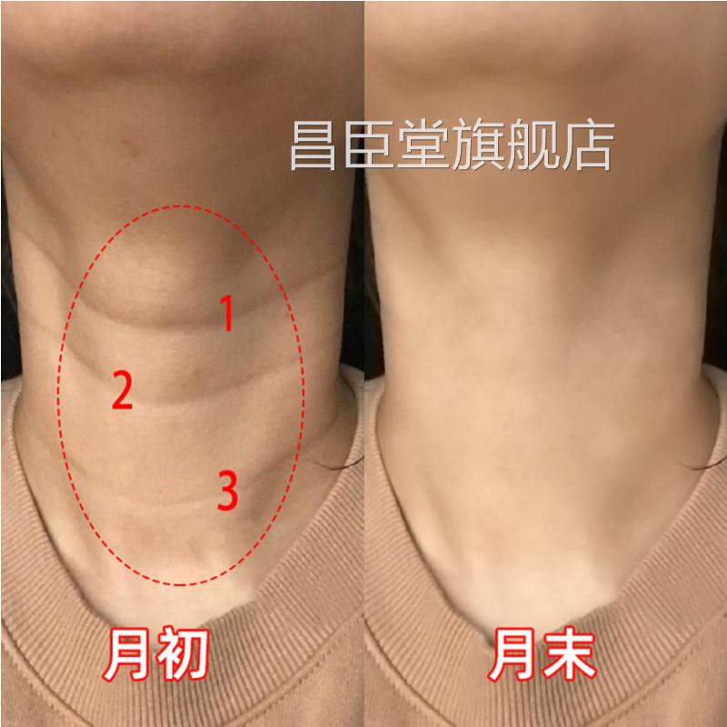美颈霜颈纹霜去颈纹皱紧致亮皙提拉淡化去纹国货脖子颈部护理神器