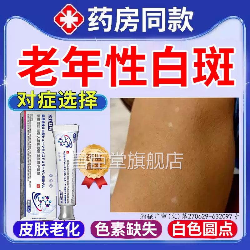 老年性白斑皮肤黄褐斑老年斑去凝胶专用手背部房脸部白点药同售TK