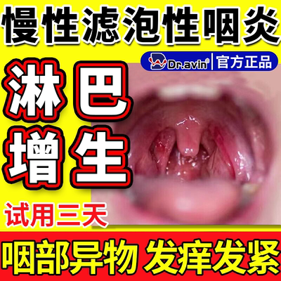 【淋巴滤泡增生】dr.avin旗舰店
