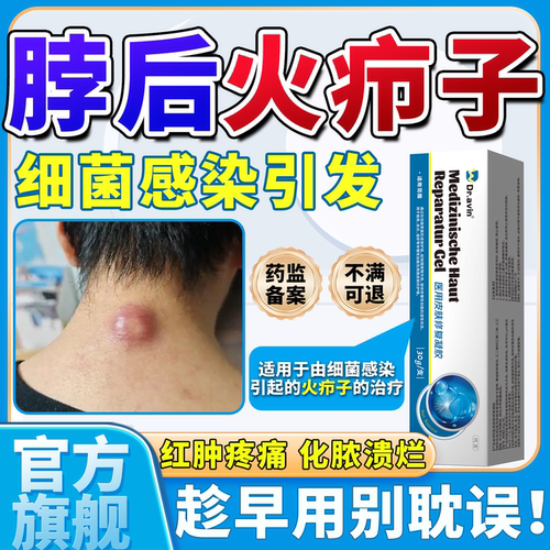 【脖后火疖子】dr.avin官方旗舰