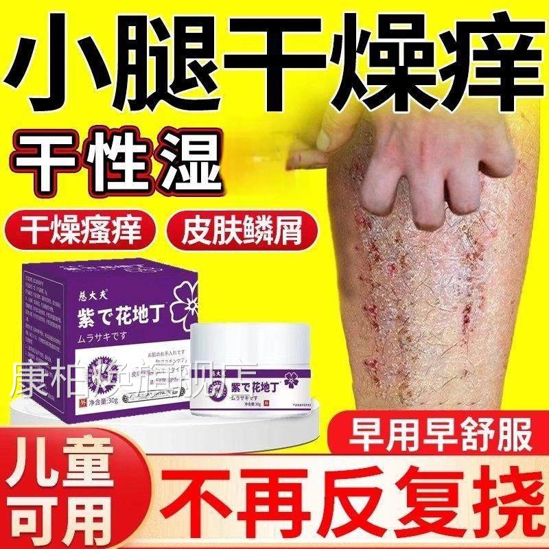 皮肤干燥瘙痒止痒膏抑膏菌补水保湿冬天小腿痒干性湿痒康柏焕旗舰