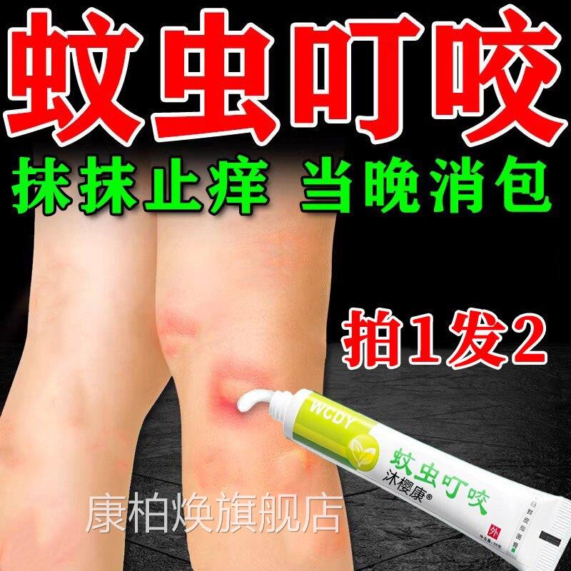 蚊虫叮咬快速止痒消红软膏婴宝宝成人跳儿童臭毒虫蚤蚊子咬肿包膏