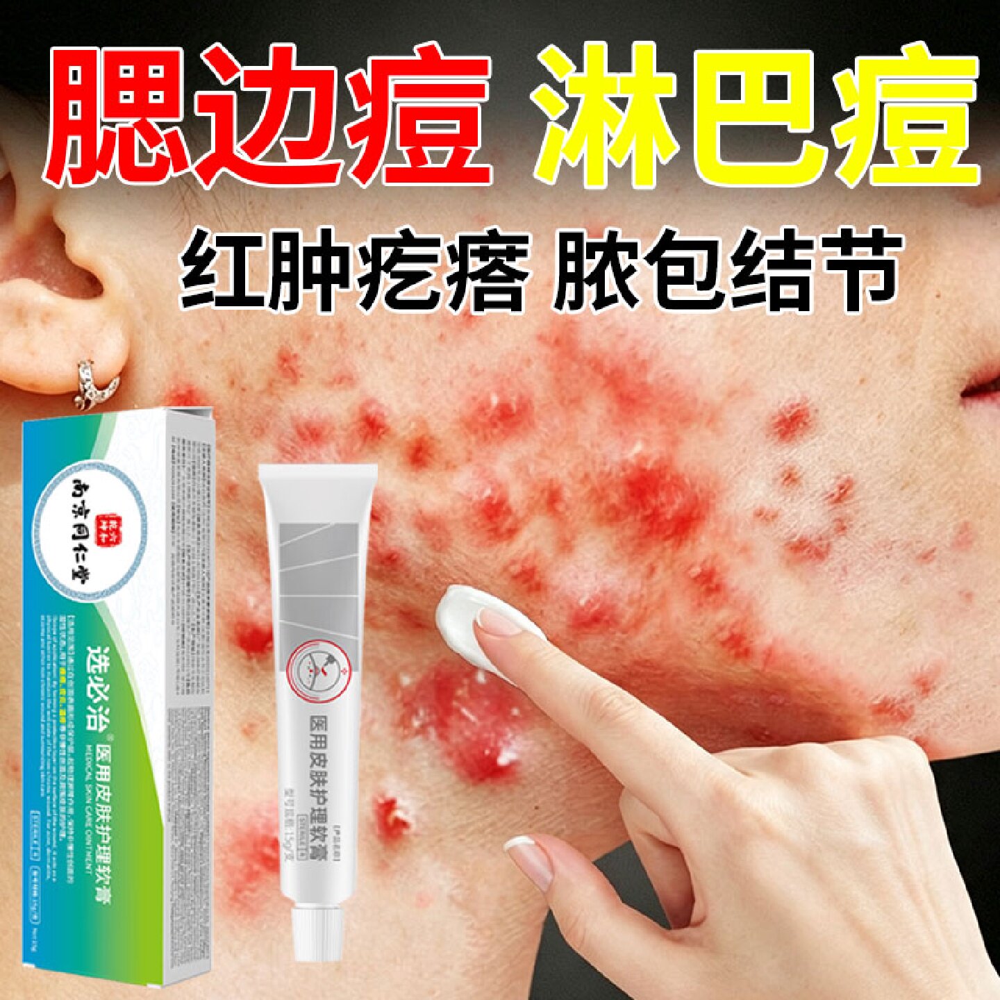 淋巴痘腮边痘红肿硬块痘痘药膏祛痘消炎玫瑰反复痤疮屏障修复旗舰