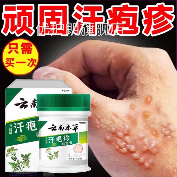 手上起小水泡抑菌汗泡疱痒中止药鹅掌风真菌感染手气湿痒疹专膏优